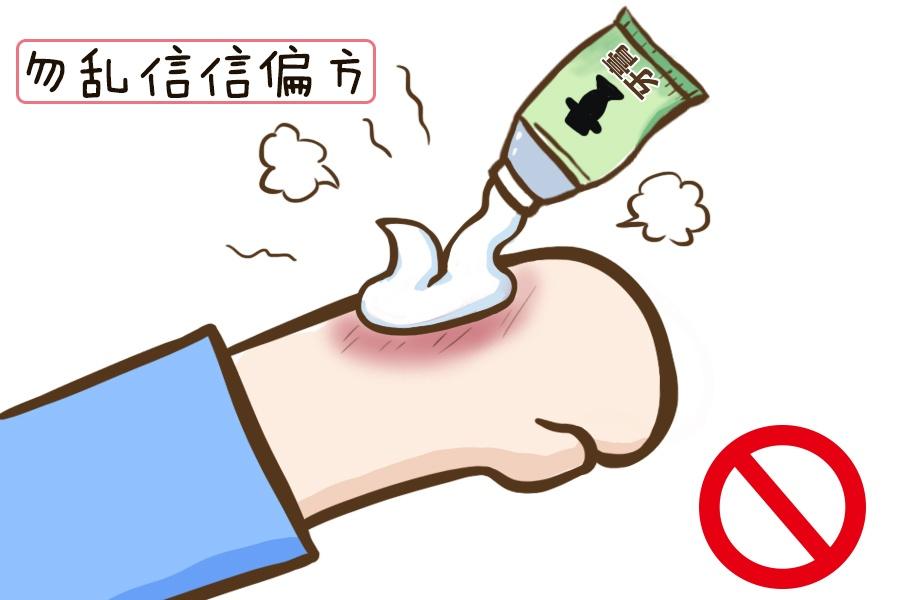 兒童燒燙傷如何緊急處理